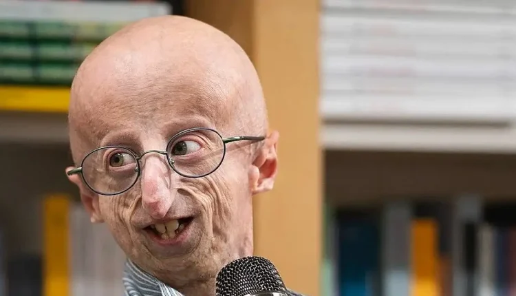 Benjamin Button Gerçek mi?