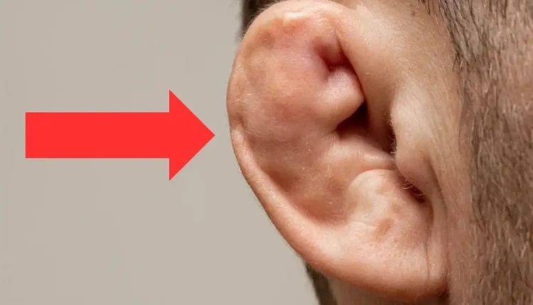 Güreşçilerin Kulakları Neden Şişer?