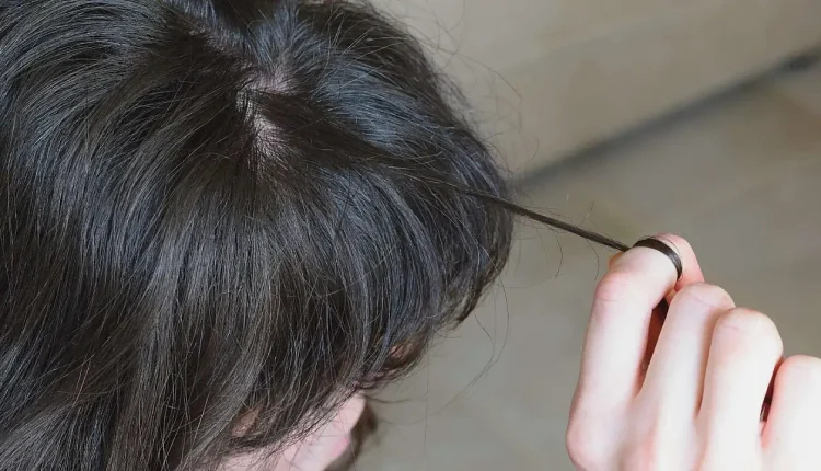 Trikotillomani Hastalığı Nedir? Saç Koparma Alışkanlığı Neden Olur ve Nasıl Geçer?