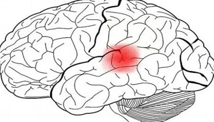 Wernicke Alanı Nedir?