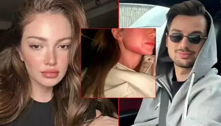 Danla Bilic'in eski sevgilisi Berk Çetin neden tutuklandı? Berk Çetin kimdir?