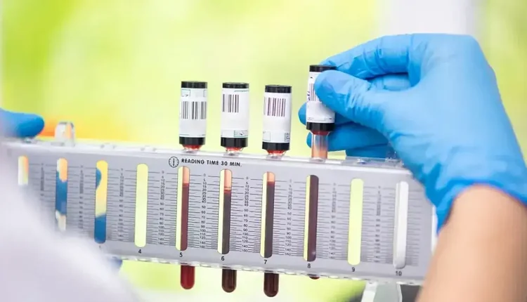 Sedimantasyon Yüksekliği Nedir?