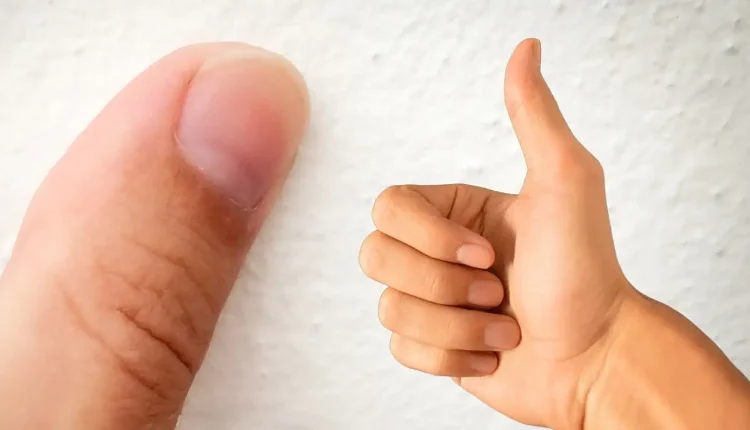 Yankesiciler Baş Parmaklarını Neden Kestirir?